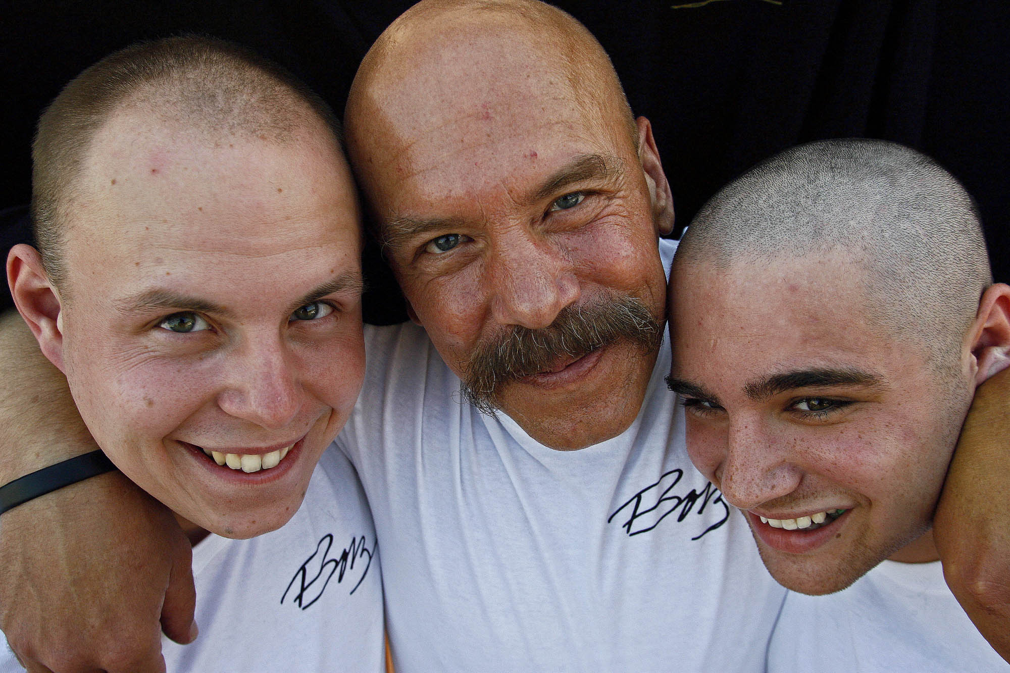 Bonded by baldness