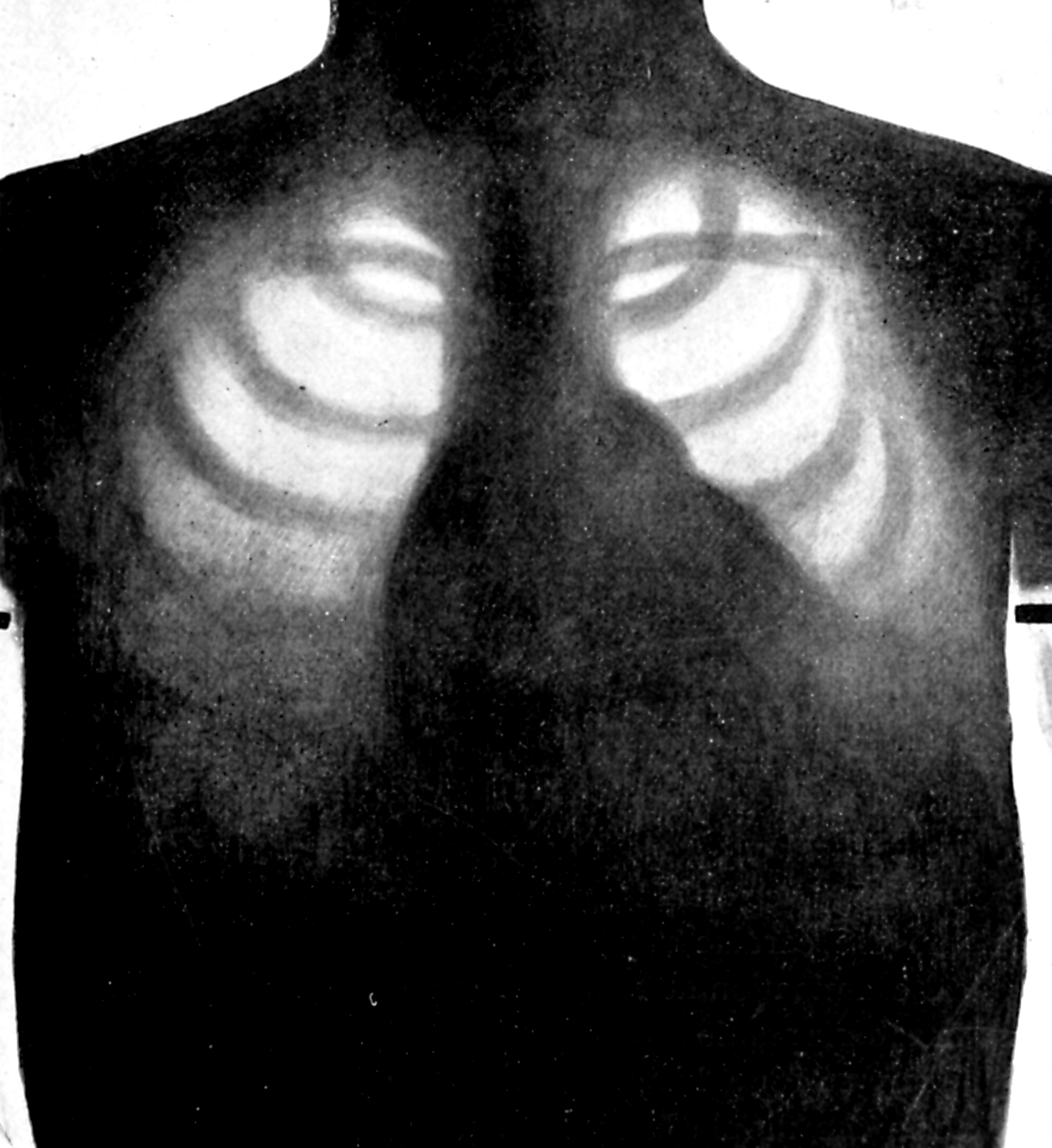 Vintage Congestion X-Ray