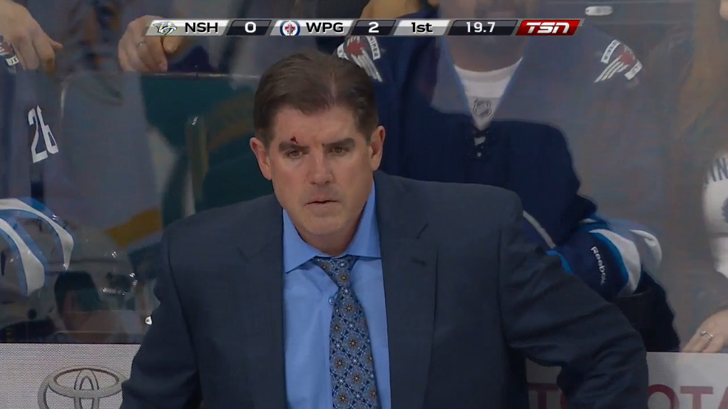 lavy puck to face