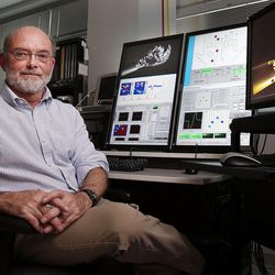 Associate professor Gregory A. Clark of the University of Utah Department of Bioengineering poses for a photo in Salt Lake City, Monday, Feb. 9, 2015.