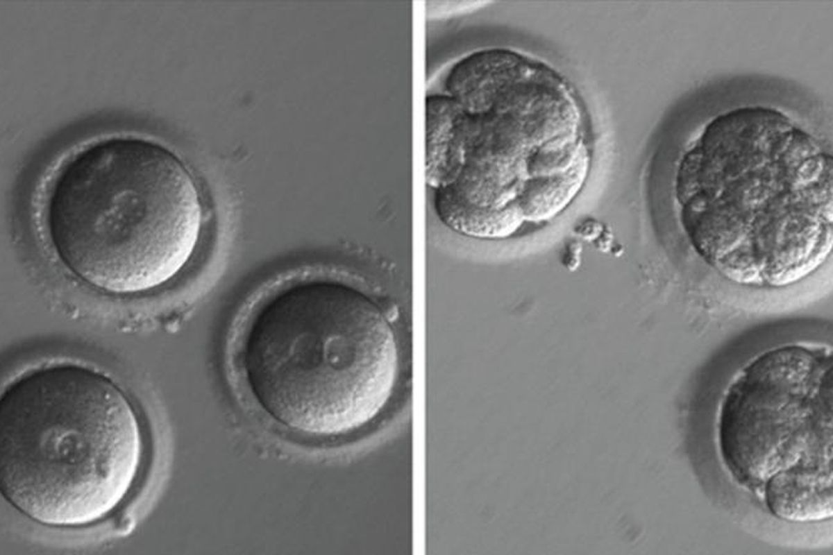 Newly fertilized eggs before gene editing, left, and embryos after gene editing and a few rounds of cell division.