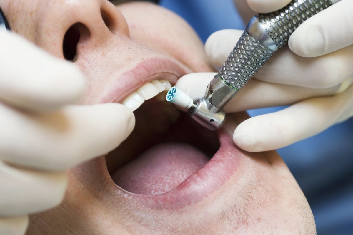 Dentist using drill to remove plaque from teeth of young male patient