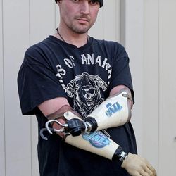 Matthew Beckstead, 36, lost his hands in an electrical accident when he was 19 and has recently participated in the study of the Utah Slanted Electrode Array, Monday, Feb. 9, 2015, in North Salt Lake City.