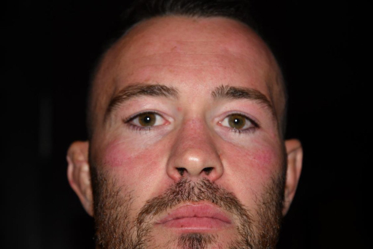 Photos of Colby Covington after alleged Jorge Masvidal assault. 
