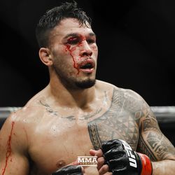 Brad Tavares was a bloody mess at TUF 27.
