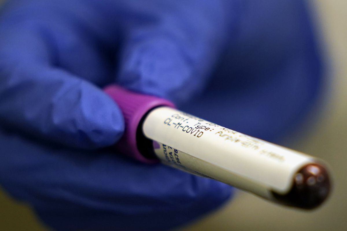 A lab assistant’s gloved hand holds a blood sample to be tested for COVID-19 antibodies. Only a handful of tests on the market have been reviewed by the FDA.