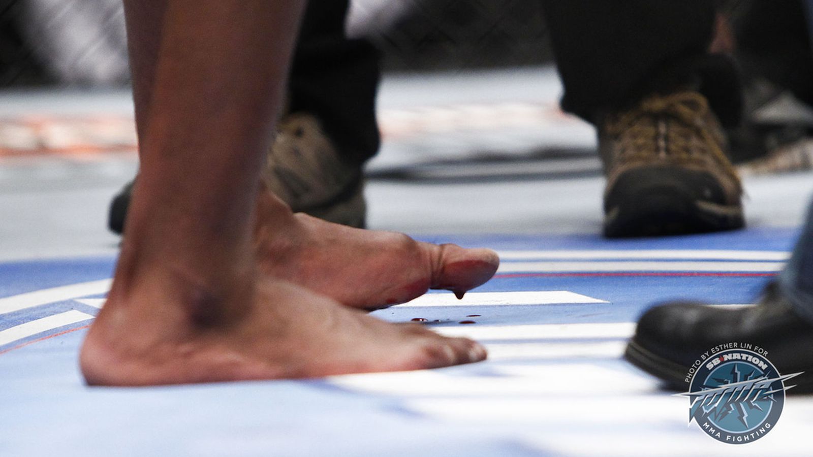 Jon Jones broken toe: 'Bones' felt a 'pop' during UFC 159 fight with ...
