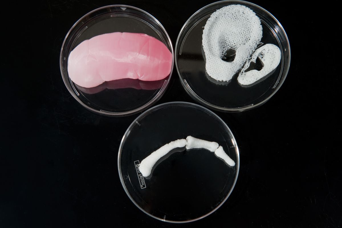 Prototype kidney, ears, and finger bone, produced with a 3D printer