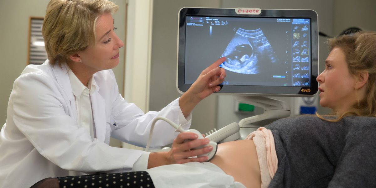 Emma Thompson and Renee Zellweger look at a sonogram.