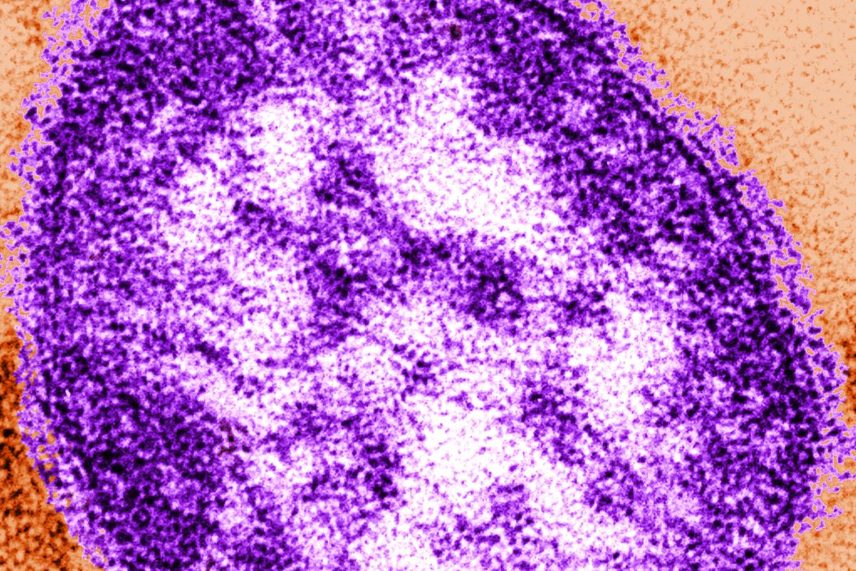 Measles virus (QUEST)