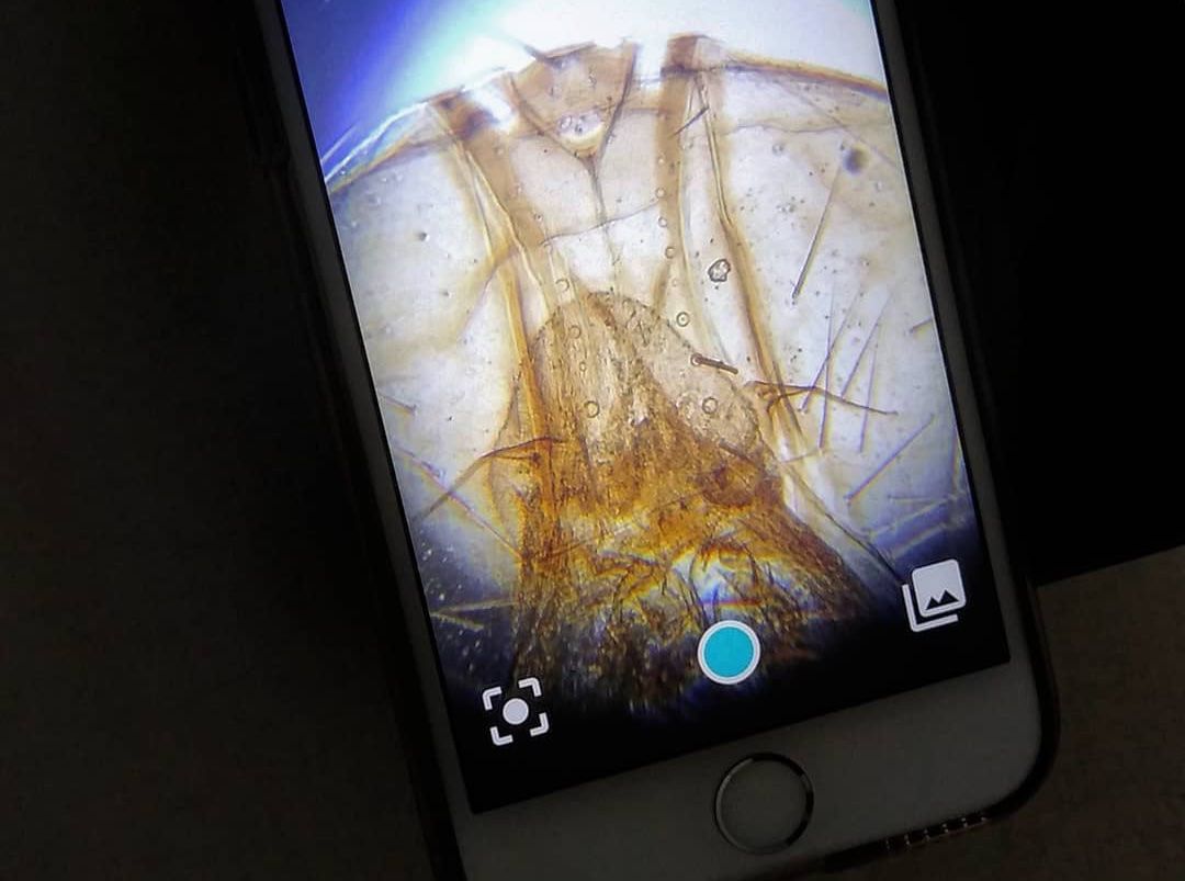 Smartphone microscope kit promises up to 1,000x magnification