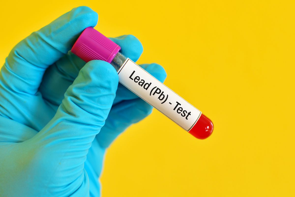 Picture depicting a blood lead level test