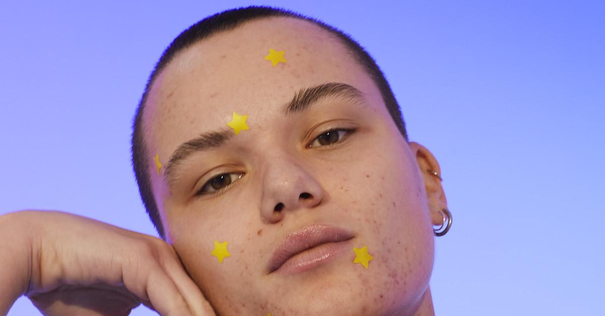 Pimple Patches And Zit Stickers Are Everywhere. Do They Work? - Vox