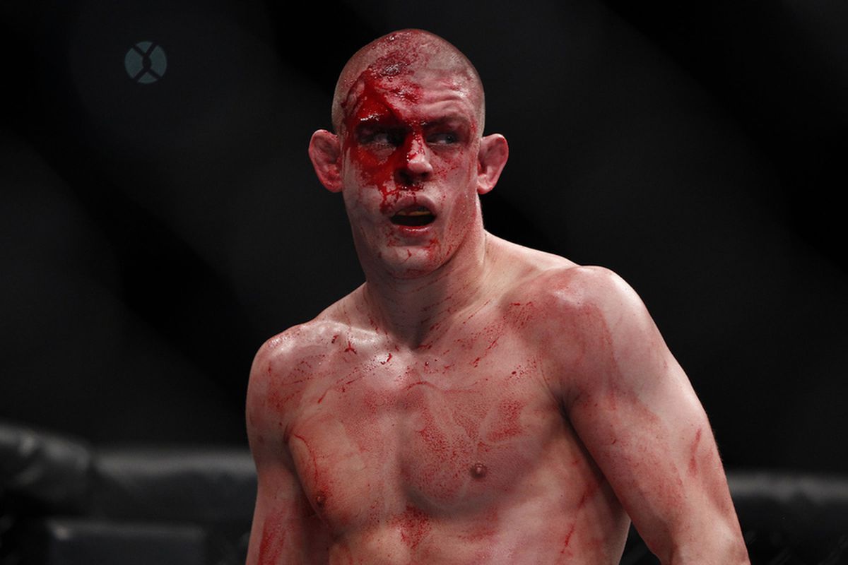 Joe Lauzon aims for his second win in a row at UFC Fight Night 50 on Friday night.