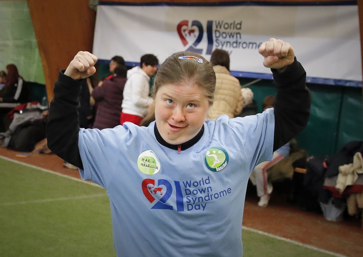 In this Wednesday, March 21, 2018, picture, a girl with the Down syndrome celebrates during a sports event in Bucharest, Romania. A study published this month in the journal Nature Medicine revealed a new use for artificial intelligence: diagnosing rare g