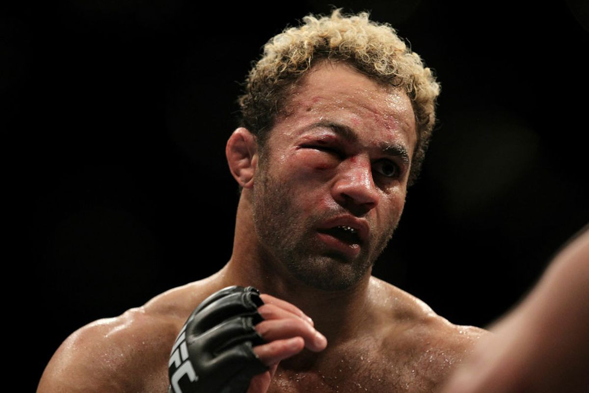 UFC on FOX 3's Josh Koscheck is determined to never look like this again. Photo via <a href="http://coolmmaphotos.com/wp-content/uploads/2010/12/11_St-Pierre_Koscheck15.jpg">CoolMMAPhotos.com</a>.