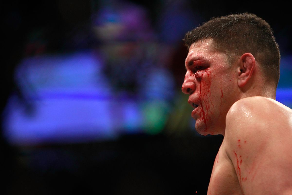 UFC 183: Silva v Diaz