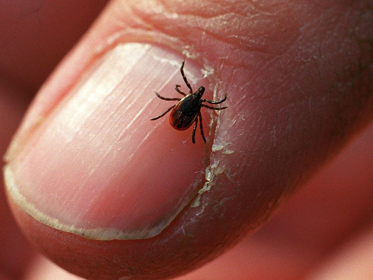 Here’s where dangerous ticks are spreading across the US — and what to do about them