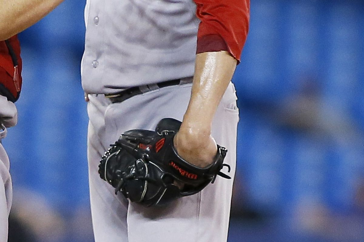 Clay Buchholz's arm