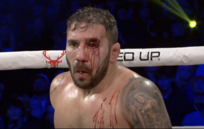 Jimmie Rivera suffers gruesome cut leading to stoppage against Jeremy Stephens at BKFC 56