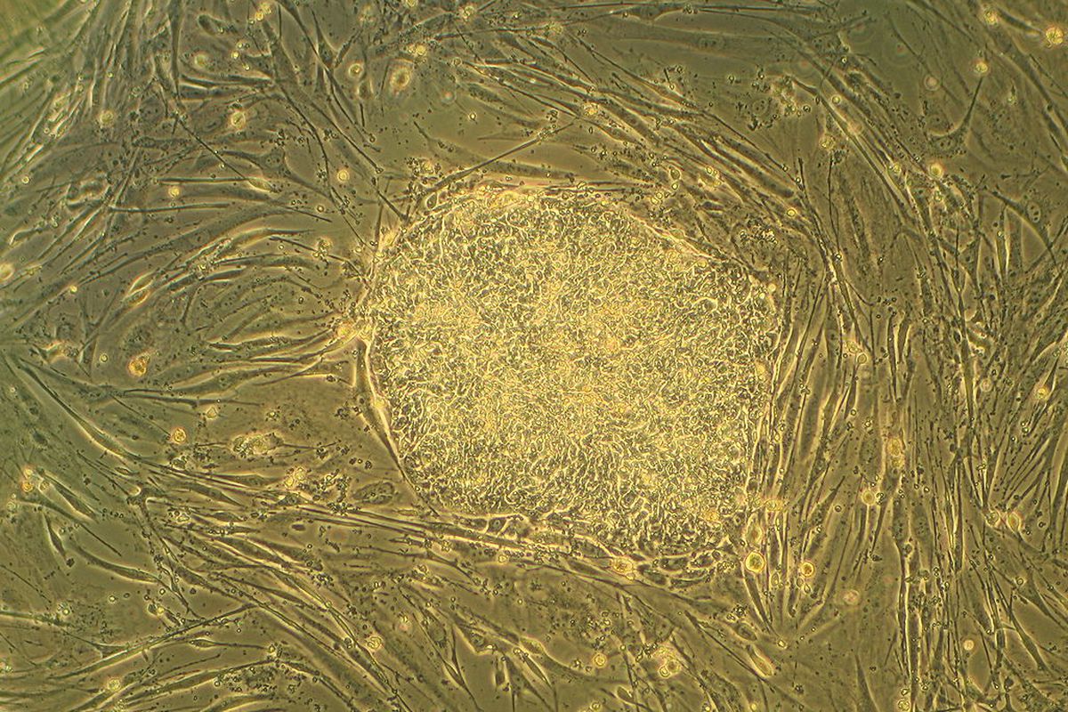 human adult stem cell