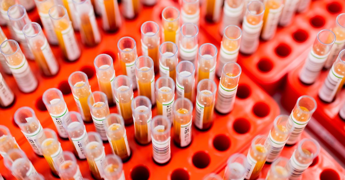 FDA alerta que alguns exames de sangue pré-natais podem ter resultados falsos