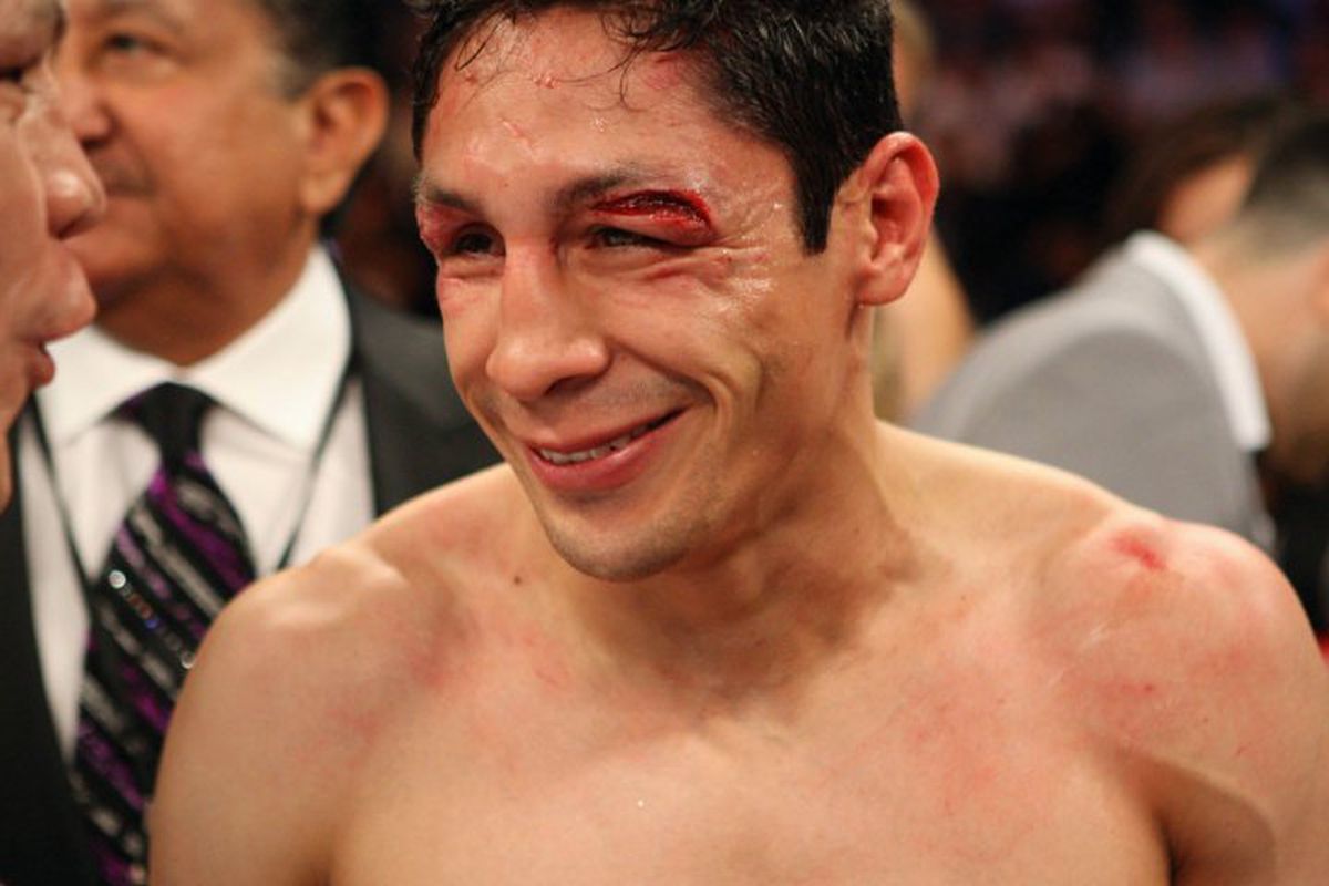 The last time we saw Israel Vazquez, it wasn't pretty. (Photo by Tom Casino/SHOWTIME)