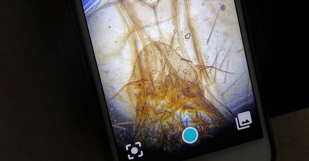 Smartphone microscope kit promises up to 1,000x magnification