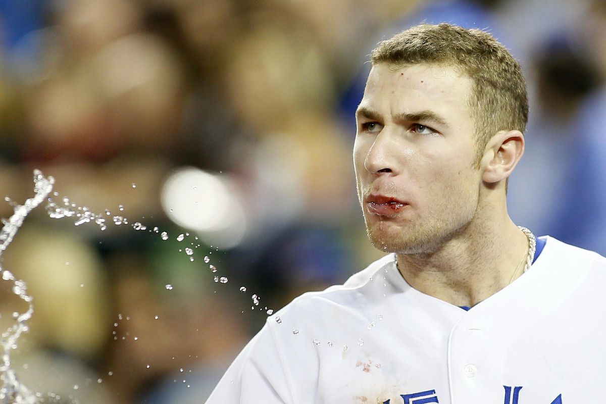 A bloodied Brett Lawrie after being hit by a Roberto Hernandez pitch.