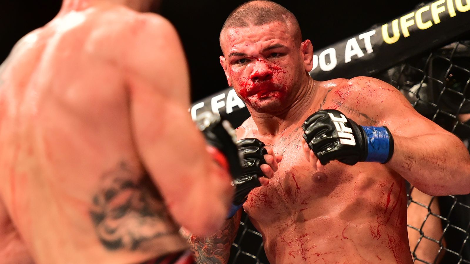 Thiago Alves' broken nose will likely require surgery - MMA Fighting
