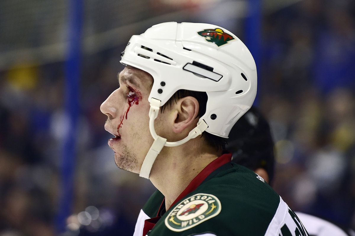 Cody McCormick took this bloody eye so the Wild could give up a short-handed goal. His sacrifice will always be remembered.