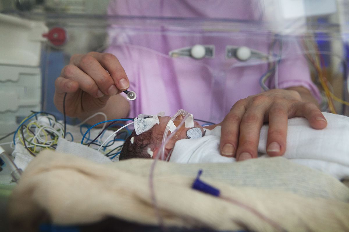 Babies born at 25 weeks, like this one, are at high risk of death or disability. Artificial wombs could change that.