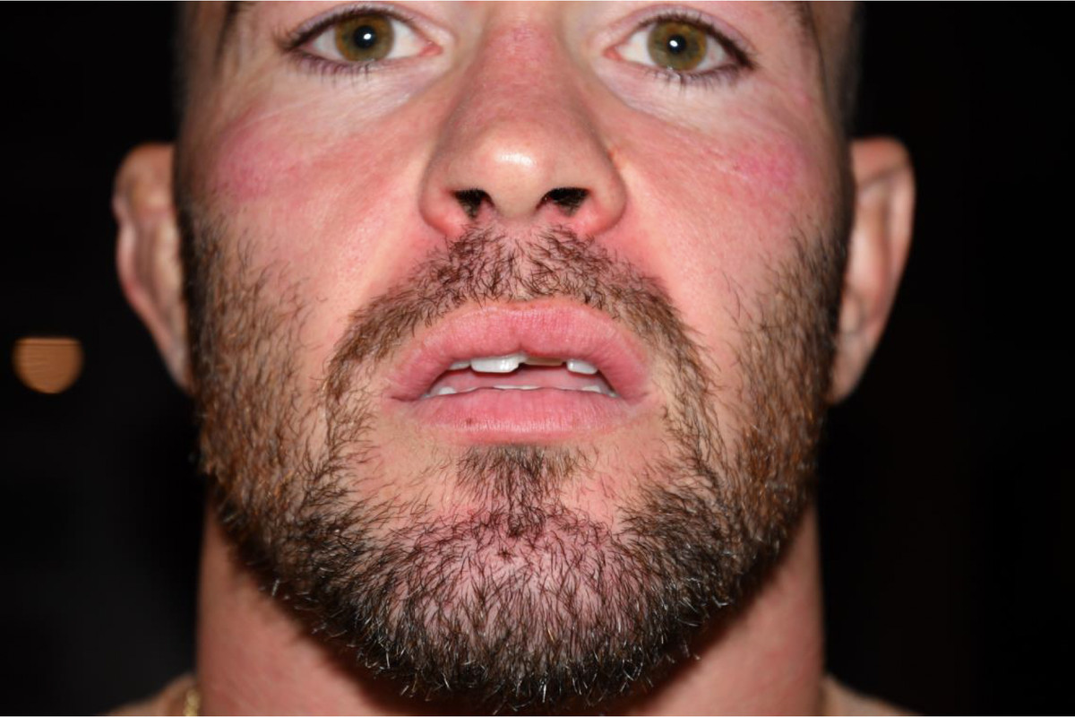 Colby Covington alleged assault photo