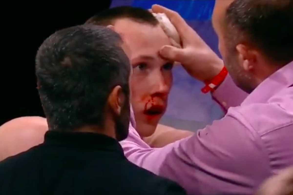 Danil Sharov suffers gruesome injury in his kickboxing debut. 