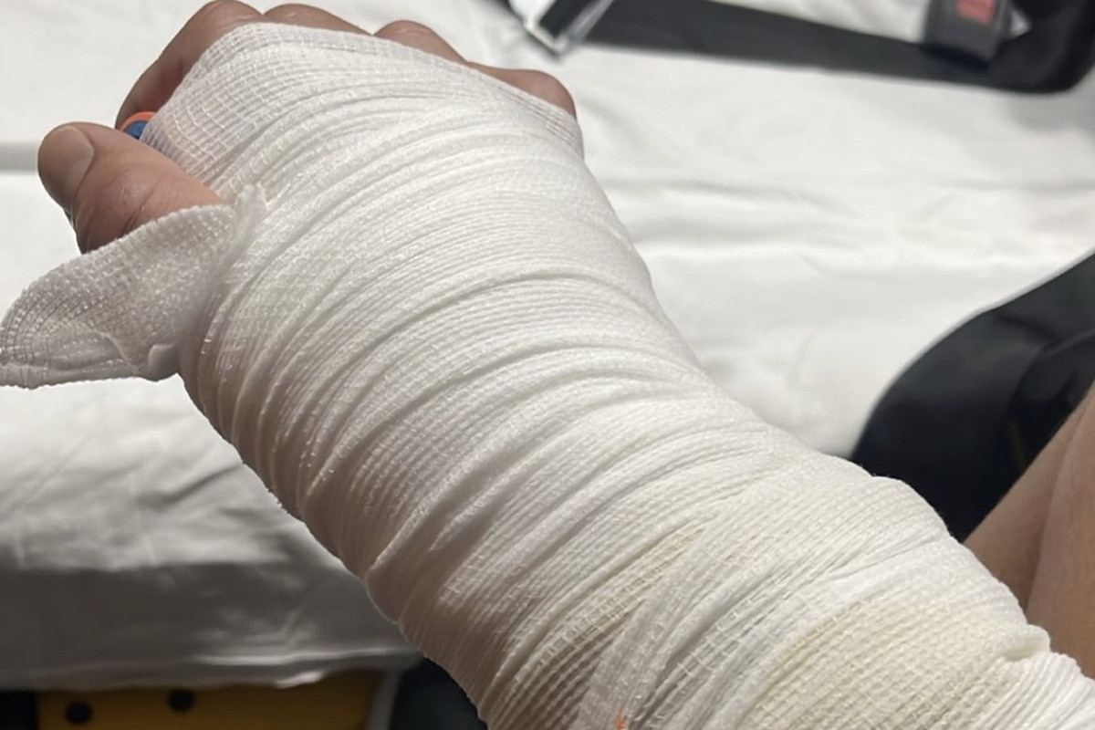 Anthony Pettis reveals broken hands after PFL Playoffs 1