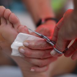 Lisa Smith-Blatchen of Driggs, Idaho receives first aid foot maintenance during the AdventurCORPS Badwater 135