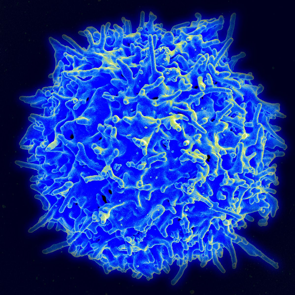A human T-cell