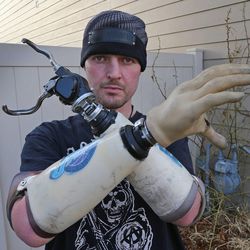 Matthew Beckstead, 36, lost his hands in an electrical accident when he was 19 and has recently participated in the study of the Utah Slanted Electrode Array, Monday, Feb. 9, 2015, in North Salt Lake City.