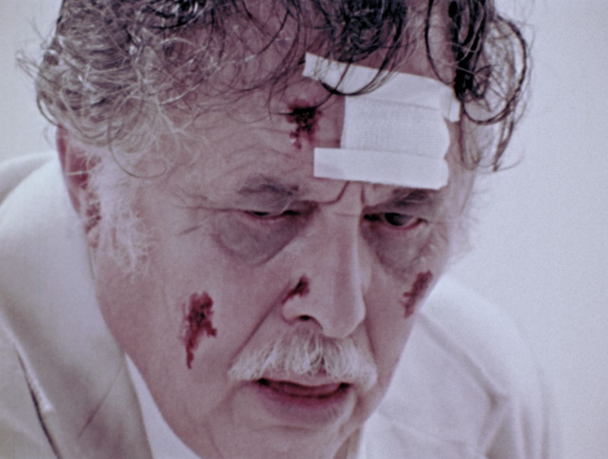 A closeup of an older man’s bloodied and bandaged face in The Amusement Parkq