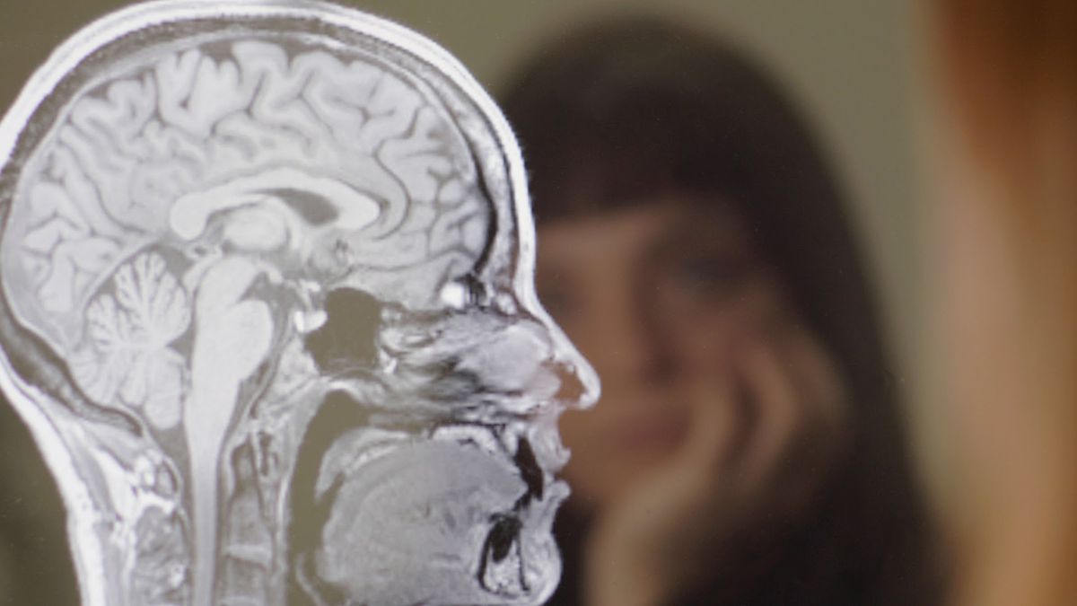 An X-ray type image of a human skull and brain, with a blurry image of Penny Lane in the background, looking contemplative.