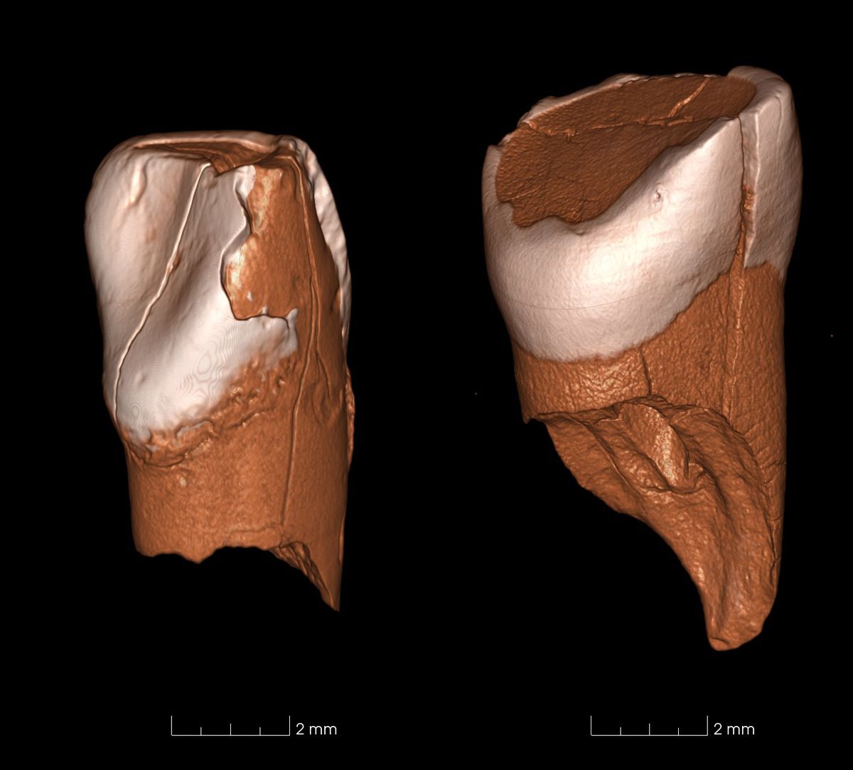 Neanderthal Teeth