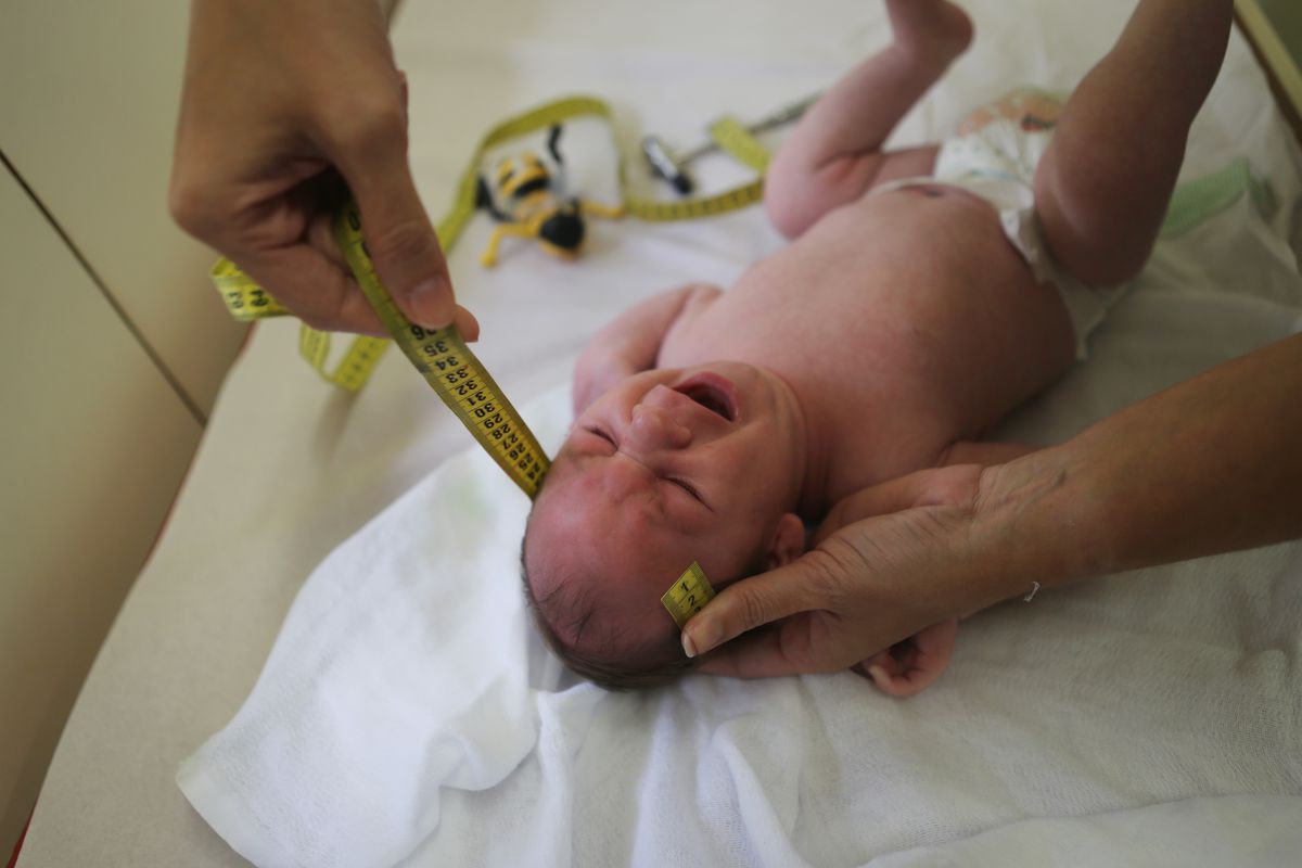 A baby in Brazil has his head measured to test for microcephaly. 