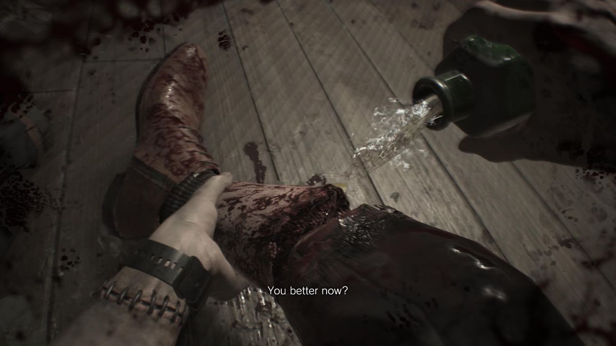 A character in Resident Evil pouring healing liquid on a leg wound.