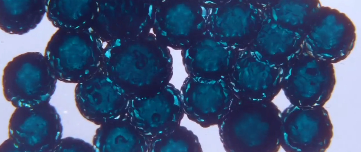 Upstream Color blue cells