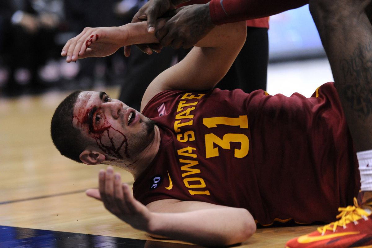 Mar 14, 2014; Kansas City, MO, USA; Iowa State Cyclones forward Georges Niang (31) is injured during the second half against the Kansas Jayhawks in the semifinals of the Big 12 Conference college basketball tournament at Sprint Center. Iowa State won