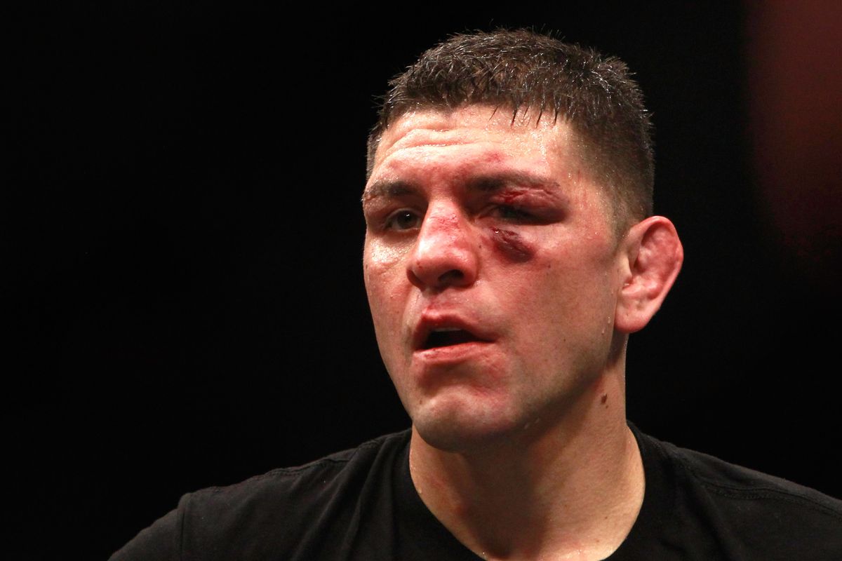 UFC 183: Silva v Diaz