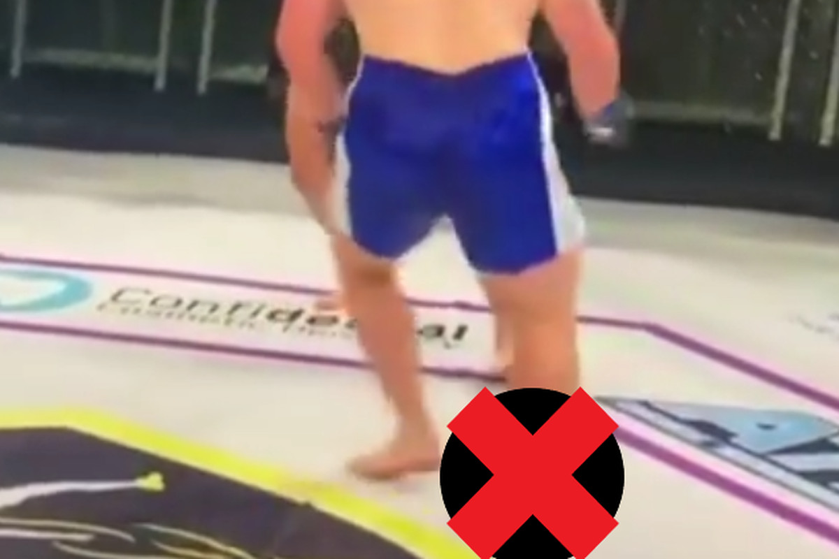 A fighter in blue trunks suffers a broken shin due to an opponent’s low kick.