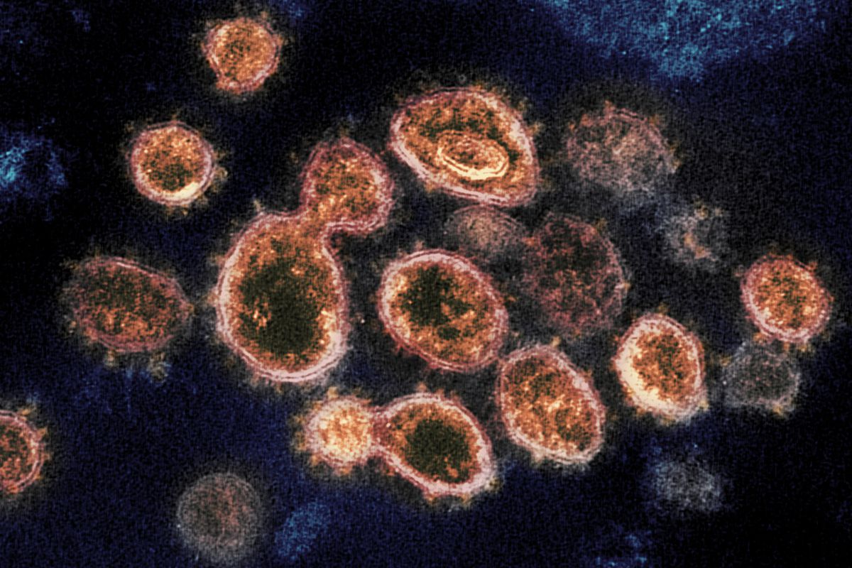 SARS-CoV-2 virus particles, which cause COVID-19, emerge from the surface of cells cultured in a lab.