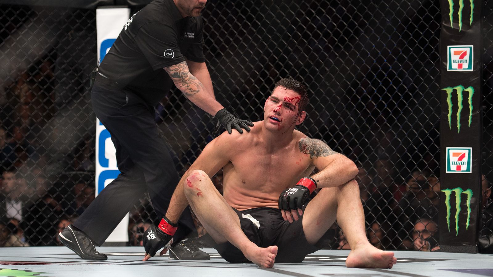 Pas encore!  Chris Weidman a subi une (autre) jambe cassée à l’UFC 292 – « C’est sur la tête du tibula, juste en dessous de mon genou »
