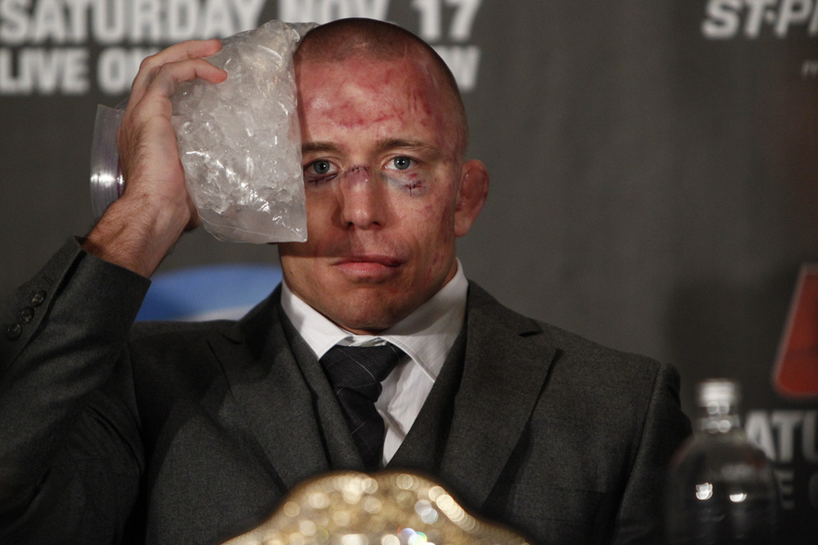 UFC 154 photos : Georges St-Pierre ices his injury at the post-fight press conference during UFC 154 at the Bell Centre in Montreal on Sat., Nov. 17, 2012.